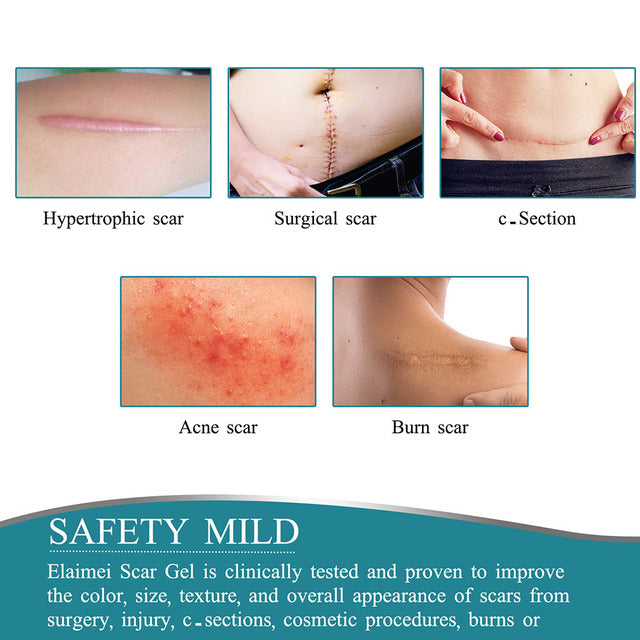 Silicone Scar Tape Roll