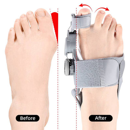 Natural Bunions Corrector Toe Spacer